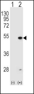 Anti-FDFT1 Rabbit Polyclonal Antibody (PE (Phycoerythrin))