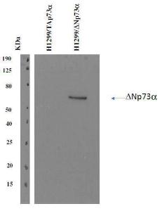 Western blot analysis of p73 isoforms using Anti-delta N p73 Antibody [DNp73-1.1]