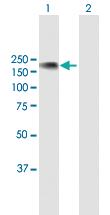 Anti-NFATC3 Mouse Polyclonal Antibody