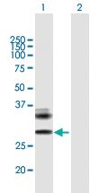 Anti-RAET1E Mouse Polyclonal Antibody