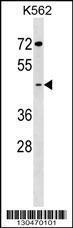 Anti-GCNT7 Rabbit Polyclonal Antibody (AP (Alkaline Phosphatase))