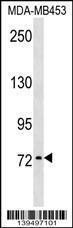 Anti-KAL1 Rabbit Polyclonal Antibody (AP (Alkaline Phosphatase))