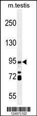 Anti-IFT88 Rabbit Polyclonal Antibody (PE (Phycoerythrin))