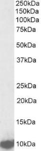 Anti-LSM2 antibody