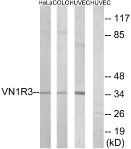 Western blot analysis of lysates from HUVEC, HeLa, and COLO cells using Anti-VN1R3 Antibody. The right hand lane represents a negative control, where the Antibody is blocked by the immunising peptide