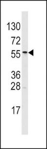 Anti-ALDH6A1 Rabbit Polyclonal Antibody (HRP (Horseradish Peroxidase))