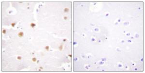 Immunohistochemical analysis of paraffin-embedded human brain tissue using Anti-c-Jun Antibody. The right hand panel represents a negative control, where the antibody was pre-incubated with the immunising peptide