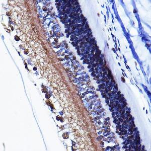 Immunohistochemistry analysis of paraffin-embedded rat eye using Anti-Cyclin D1 (phospho Thr286) Antibody (A305286) at a dilution of 1:100 (40X lens). Perform high pressure antigen retrieval with 10 mM citrate buffer pH 6.0 before commencing with IHC staining protocol