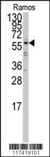 Anti-IRF5 Rabbit Polyclonal Antibody