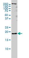 Anti-PTN Mouse Monoclonal Antibody [clone: 5C3]