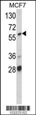 Anti-RAF Rabbit Polyclonal Antibody (AP (Alkaline Phosphatase))