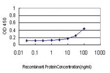 Anti-AKT1 Mouse Monoclonal Antibody [clone: 6G6]