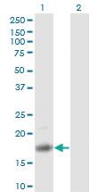 Anti-PTN Mouse Monoclonal Antibody [clone: 5C3]