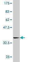 Anti-TAOK3 Mouse Monoclonal Antibody [clone: 1D2]