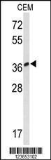 Anti-MTNR1A Rabbit Polyclonal Antibody (FITC (Fluorescein Isothiocyanate))