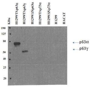 Western blot analysis of cell lysates from particular transfectants of TA p63 alpha, TA p63 gamma, delta N p63 alpha, TA p73 alpha, and delta N p73 alpha, using Anti-p63 Antibody [TAp63-4.1] . This analysis confirms the specificity of Anti-p63 Antibody [TAp63-4.1] for TA p63 isoform of p63 protein.