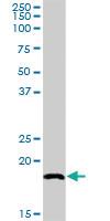 Anti-SNX12 Rabbit Polyclonal Antibody