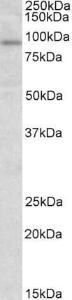 Anti-STAT3 Antibody (A83415) (1 µg/ml) staining of Human Heart lysate (35 µg protein in RIPA buffer). Primary incubation was 1 hour. Detected by chemiluminescence