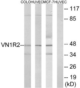 Anti-VN1R2 antibody