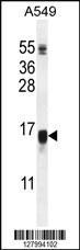 Anti-WFDC12 Rabbit Polyclonal Antibody