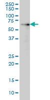 Anti-AKT1 Mouse Monoclonal Antibody [clone: 2H1]