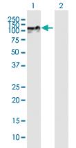 Anti-ZNF710 Mouse Polyclonal Antibody