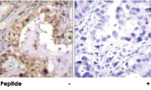 Anti-BCL2L1 Rabbit Polyclonal Antibody