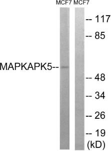 Western blot analysis of lysates from MCF-7 cells using Anti-MAPKAPK5 Antibody The right hand lane represents a negative control, where the antibody is blocked by the immunising peptide