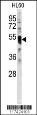 Anti-IRF8 Rabbit Polyclonal Antibody