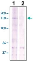 Anti-ROCK2 Rabbit Polyclonal Antibody