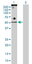 Anti-2610017G09Rik, ADP-GK Rabbit Polyclonal Antibody