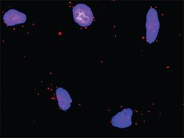 Anti-RUNX1T1 + HDAC1 Antibody Pair