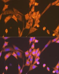 Immunofluorescence analysis of NIH-3T3 cells using Anti-Raptor Antibody [ARC1375] (A309112) at a dilution of 1:100 (40X lens). DAPI was used to stain the cell nuclei (blue)