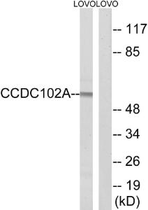 Anti-CCDC102A Rabbit Polyclonal Antibody