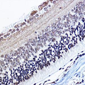 Immunohistochemistry analysis of paraffin-embedded mouse eye using Anti-Cyclin D1 (phospho Thr286) Antibody (A305286) at a dilution of 1:100 (40X lens). Perform high pressure antigen retrieval with 10 mM citrate buffer pH 6.0 before commencing with IHC staining protocol