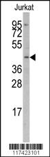 Anti-IRF8 Rabbit Polyclonal Antibody