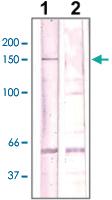 Anti-ROCK2 Rabbit Polyclonal Antibody