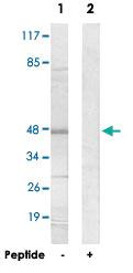 Anti-CADM2 Rabbit Polyclonal Antibody