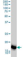 Anti-SNX12 Mouse Monoclonal Antibody [clone: 2C10]