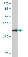 Anti-VDAC1 Mouse Monoclonal Antibody [clone: 4C4]