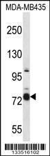 Anti-CASS4 Rabbit Polyclonal Antibody (Biotin)