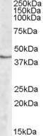 Anti-SPHK1 Antibody (A83416) (2 µg/ml) staining of Human Peripheral Blood Mononucleocyte lysate (35 µg protein in RIPA buffer). Primary incubation was 1 hour. Detected by chemiluminescence