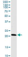 Anti-HDDC3 Mouse Monoclonal Antibody [clone: 7E6]