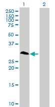 Anti-RNF138 Mouse Polyclonal Antibody