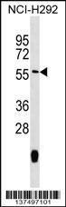 Anti-MTRF1 Rabbit Polyclonal Antibody (AP (Alkaline Phosphatase))