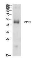 Western blot analysis of extracts from HepG2 cells using Anti-VIPR1 Antibody