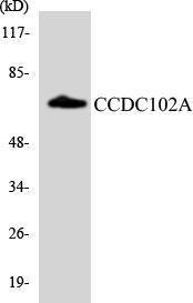 Western blot analysis of the lysates from HepG2 cells using Anti-CCDC102A Antibody