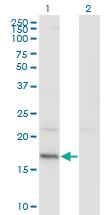 Anti-HDDC3 Mouse Monoclonal Antibody [clone: 7E6]