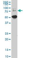 Anti-DCP1A Mouse Monoclonal Antibody [clone: 2F11]