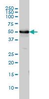 Anti-TUBA4A Mouse Monoclonal Antibody [clone: 2E11]